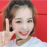 Niziu(ニジュー)マコ私服や衣装でいつもズボンなのはなぜ？怪我してる説も？